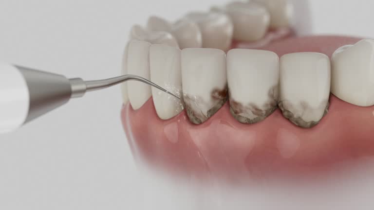 Trusted Tooth Extraction service in Irwin, SC - Dentist Open Now